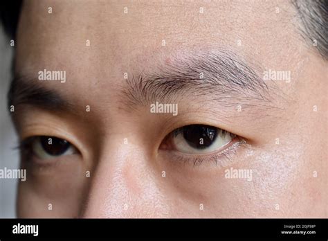 china crease eye